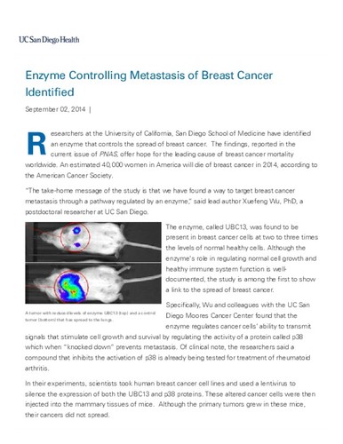 Enzyme Controlling Metastasis of Breast Cancer Identified