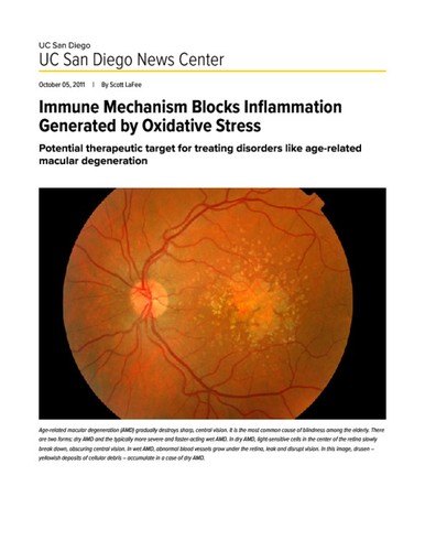 Immune Mechanism Blocks Inflammation Generated by Oxidative Stress