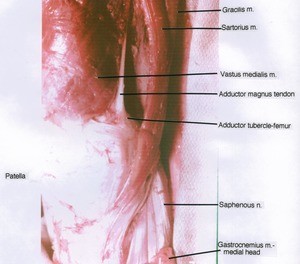 Natural color photograph of right knee, anteromedial view, showing bones, muscles, tendon and nerve