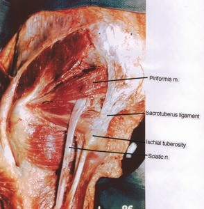 Natural color photograph of dissection of the left upper leg, posterior view, showing the exiting of the sciatic nerve below the piriformis muscle and the related structures