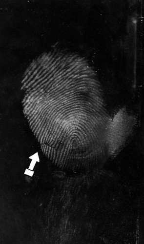 Hickman fingerprint