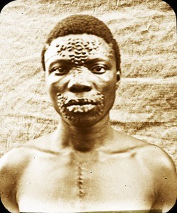 Man with scarification patterns, Congo, ca. 1900-1915