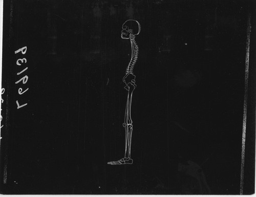 HEALTH UNIT - Posture. Set #5, L69139 - Side View of Skeleton out of Proper Alignment
