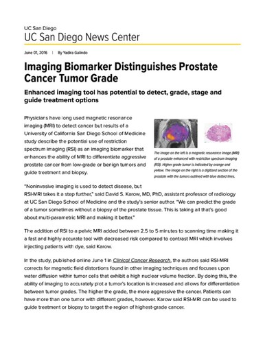 Imaging Biomarker Distinguishes Prostate Cancer Tumor Grade