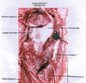 Natural color photograph of dissection of the left femoral head and neck, posterior view, showing the associated structures