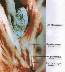Natural color photograph of dissection of dorsal surface of finger, showing extensor tendons