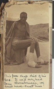 Patient with sores, Dodoma, Tanzania, July-November 1917