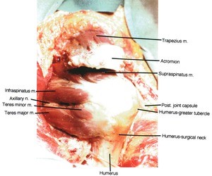 Natural color photograph of dissection of the right shoulder, lateral view, showing major bone structures, muscles, and the axillary nerve