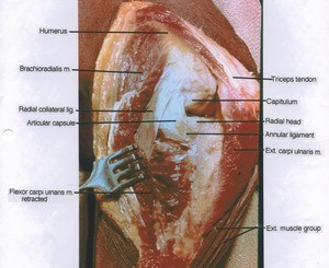 Natural color photograph of left elbow, lateral view, showing muscles, bones, ligament and tendons