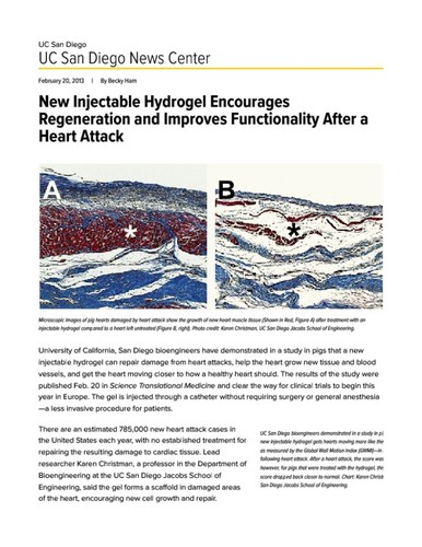 New Injectable Hydrogel Encourages Regeneration and Improves Functionality After a Heart Attack