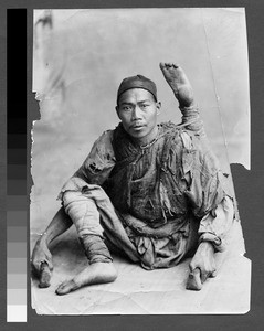 Man with paralyzed leg, Sichuan, China, 1895
