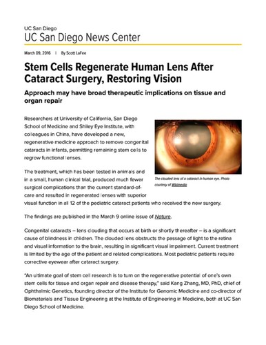 Stem Cells Regenerate Human Lens After Cataract Surgery, Restoring Vision
