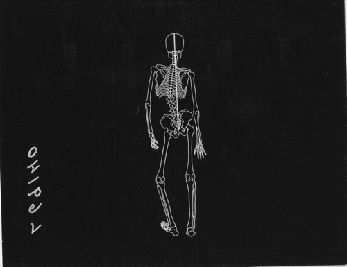HEALTH UNIT - Posture. Set #6, L6914- - Rear View of Skeleton out of Proper Alignment