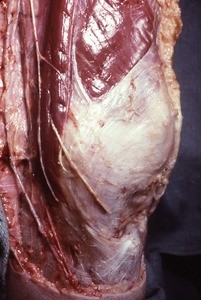 Natural color photograph of dissection of the left knee, medial view, showing muscles, tendons and superficial nerves