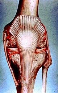 Illustration of left knee, anterior view, emphasizing genicular arteries, patellar retinacula, medial meniscus and lateral meniscus, infrapatellar ligament