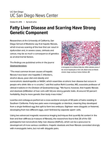 Fatty Liver Disease and Scarring Have Strong Genetic Component