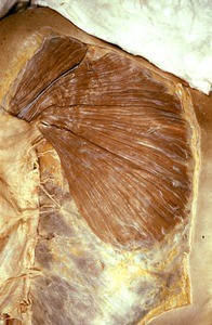 Natural color photograph of dissection of the right thorax, anterior view, with the skin removed to reveal the pectoralis major and deltoid muscles