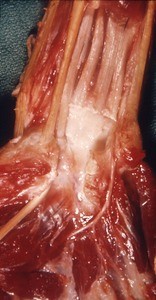 Natural color photograph of dissection of the right wrist, anterior view