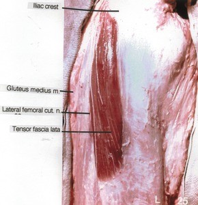 Natural color photograph of dissection of the right thigh, lateral view