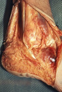 Natural color photograph of dissection of the right ankle, lateral view