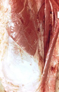 Natural color photograph of dissection of the left knee, anteromedial view, with the skin removed and sartorius muscle retracted medially to expose underlying muscles and nerves