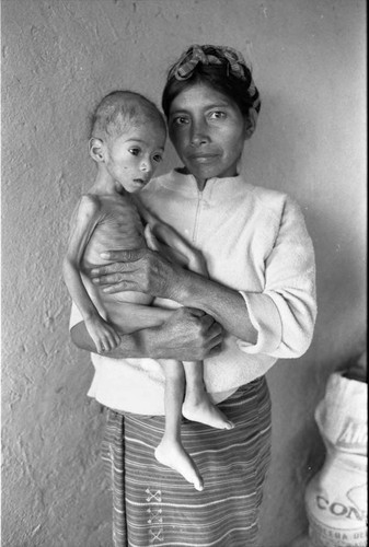 Refugee woman and malnurished child, Chiapas, 1983