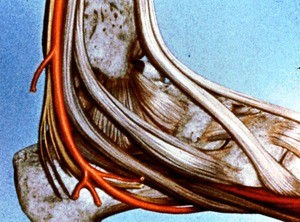 Illustration of dissection of deep structures of right ankle, lateral view