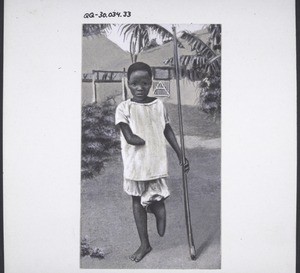 A mutilated child from the Congo