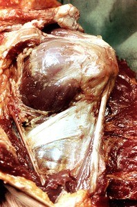 Natural color photograph of dissection of the right shoulder, lateral view, with the deltoid muscle removed to expose the rotator cuff muscles and tendon of the long head of the biceps brachii muscle