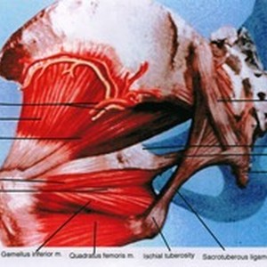 Illustration of left hemipelvis and hip joint, posterior view, showing ...