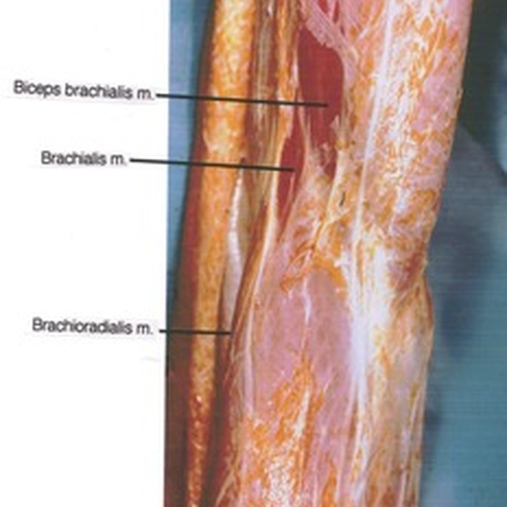 Understanding the Brachialis Muscle Anatomy, image size:999x999